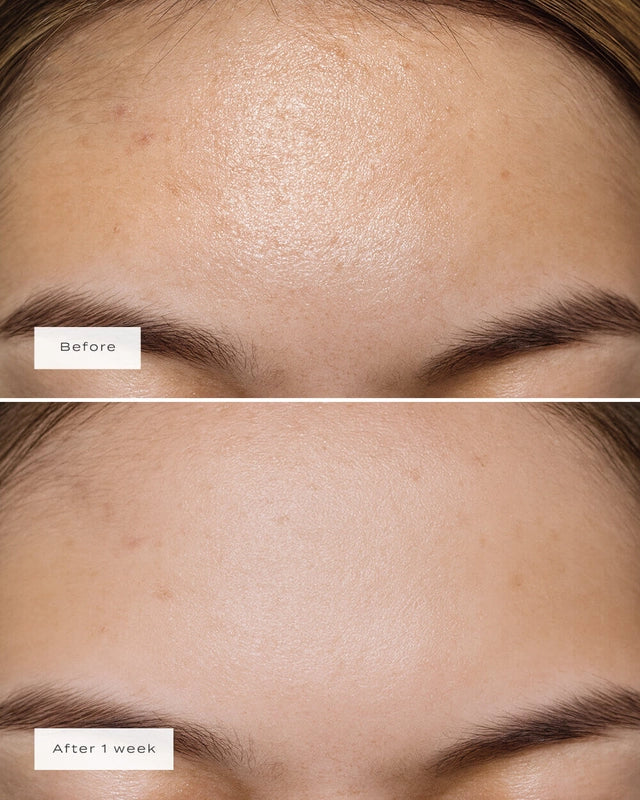 Veu | Forehead Patches
