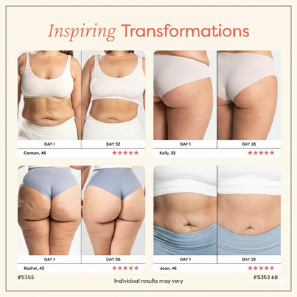 Thermi Slim | Body Sculpting Device