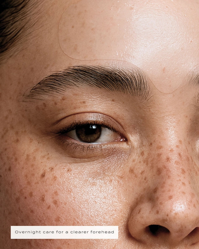 Veu | Forehead Patches